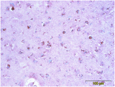 Human CDNF Mouse Monoclonal Antibody Clone 6G5