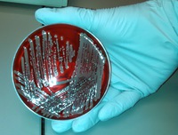 Human commensals producing a novel antibiotic impair pathogen colonization