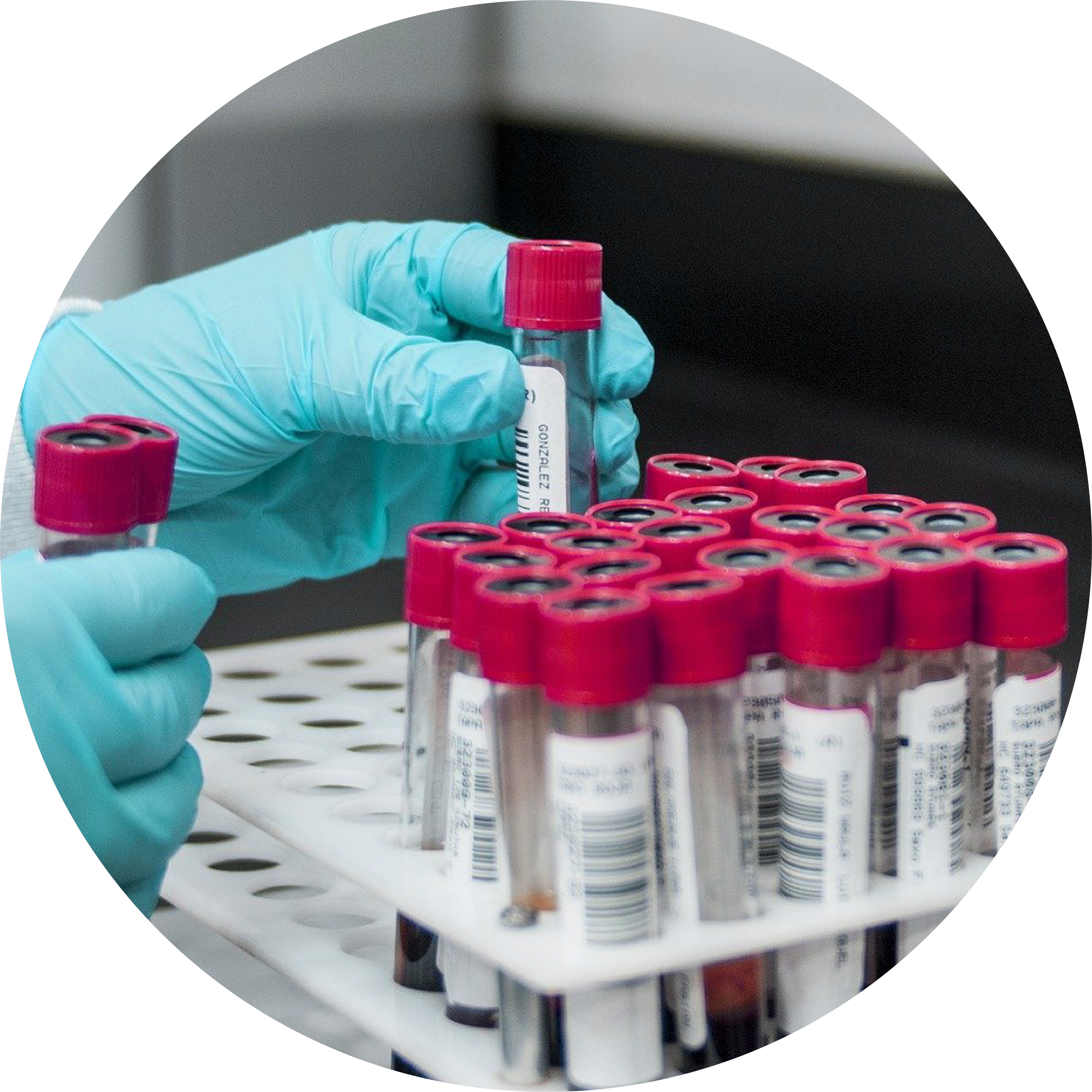 Therapeutic Drug Monitoring Assays